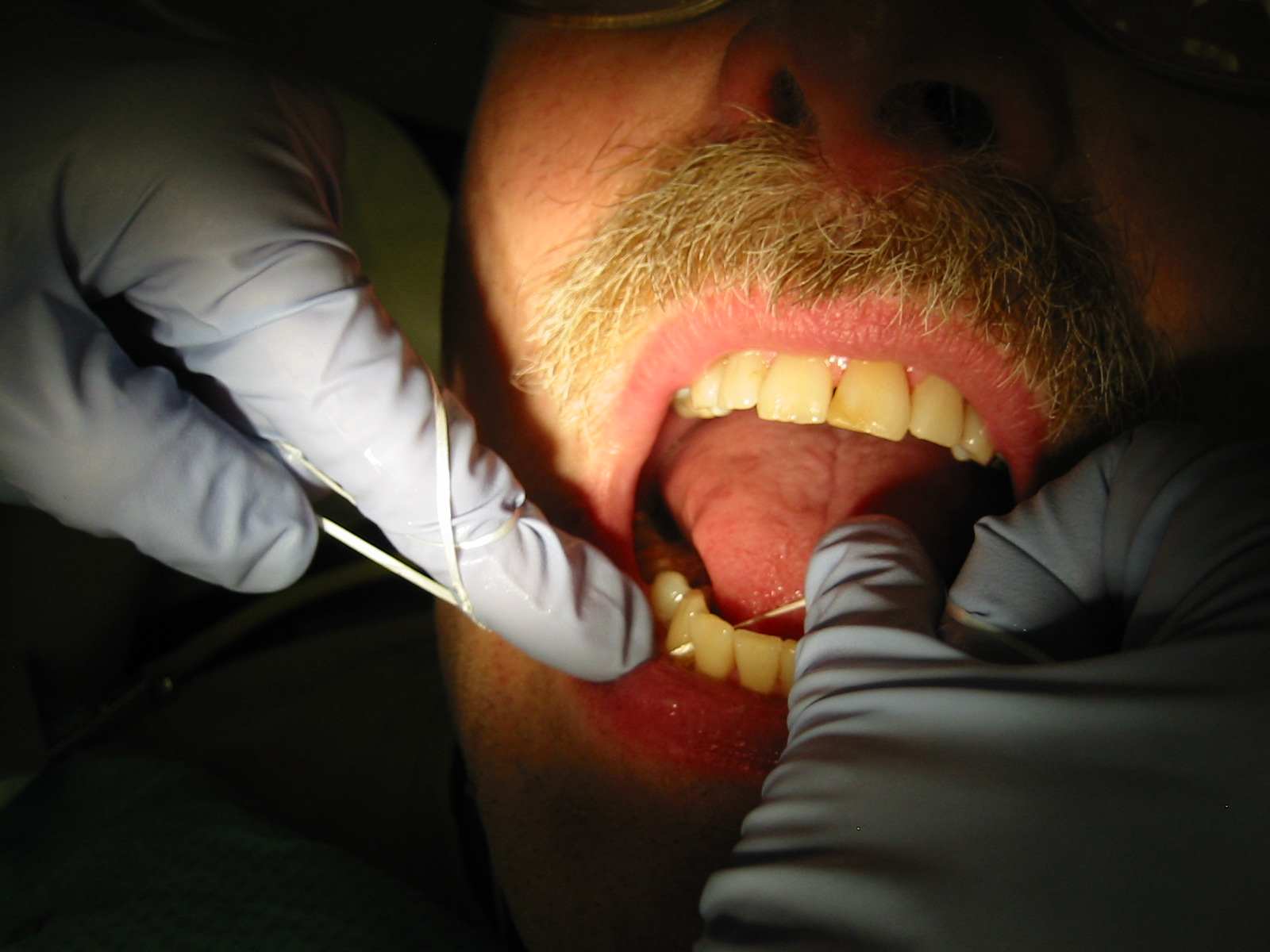 Dental braces - Wikipedia