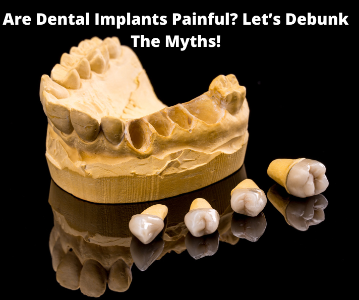 Are Dental Implants Painful? Let’s Debunk the Myths!
