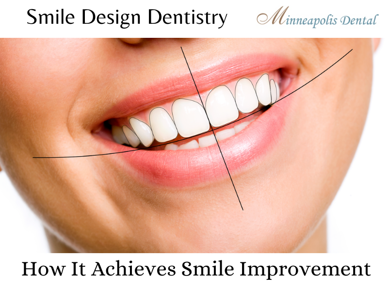 Smile Design Dentistry